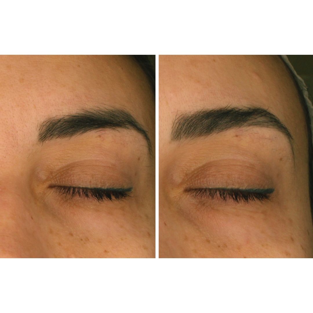 imagen de antes y después de controno de ojos, pruebas reducción de ojeras, salud ocular skincare. comprar contorno de ojos.