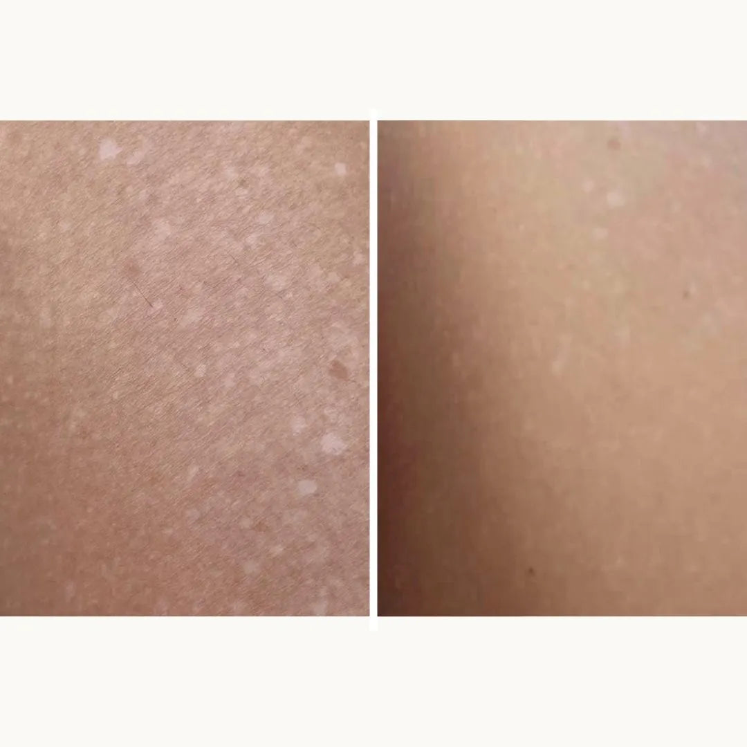 comparativa piel con y sin SPF50 FARMA DORSCH mejora del tono y reducción de manchas visibles