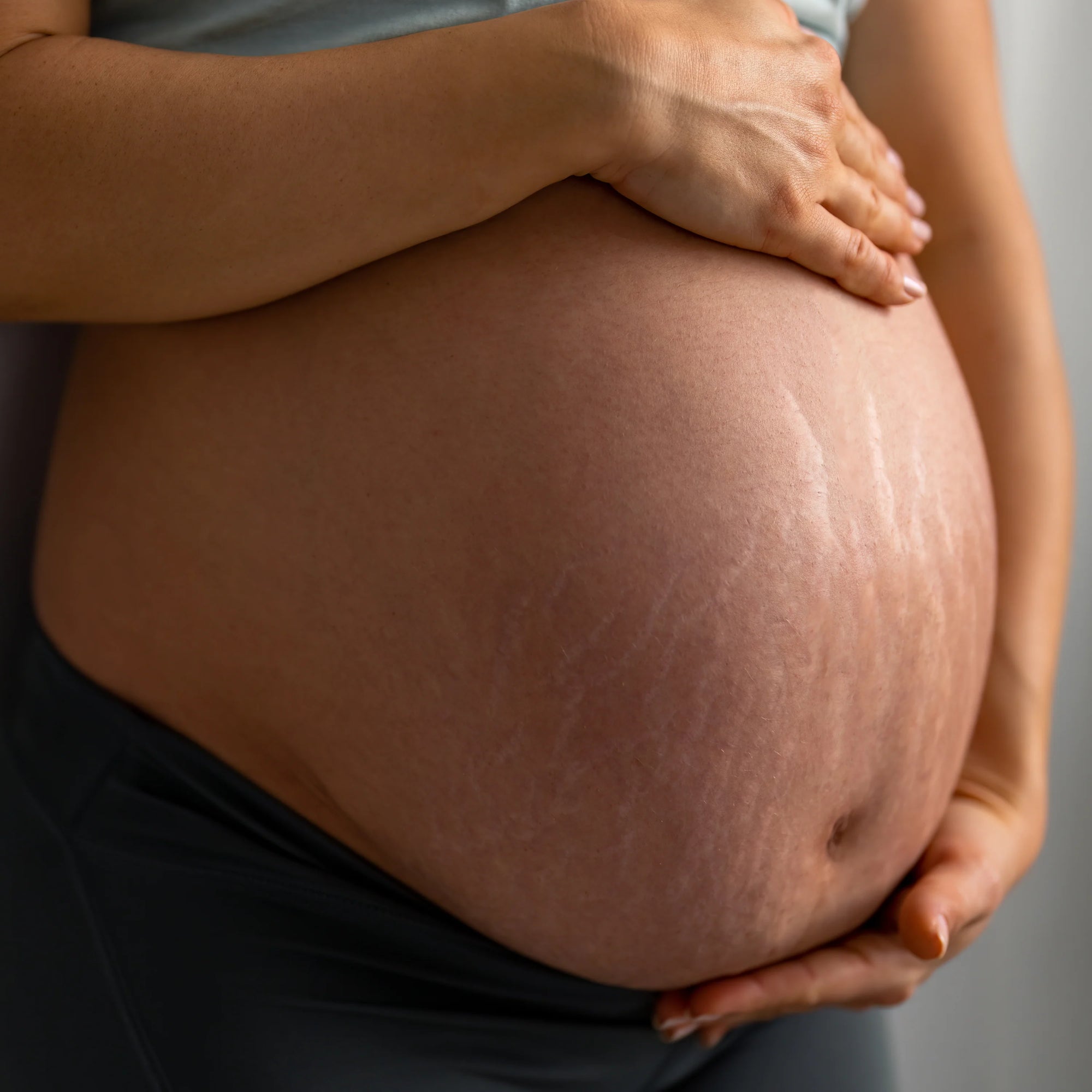 barriga de una mujer embarazada de unos 8 meses con estrías 