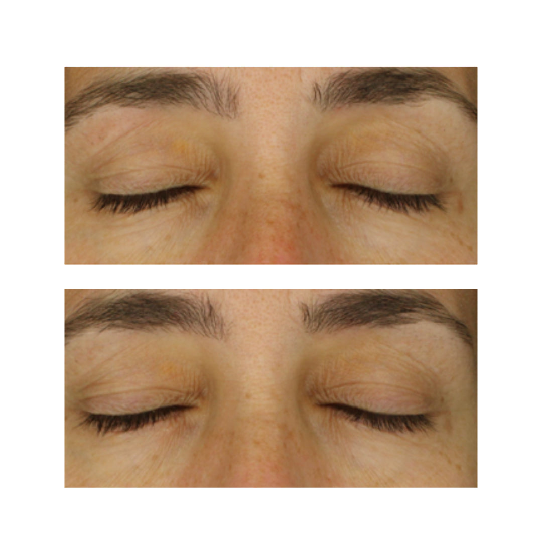 resultados visibles contorno de ojos FARMA DORSCH reducción de ojeras y mejora del tono en la mirada