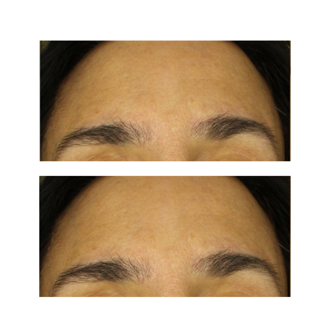 resultados visibles Retinol + Vitamina C FARMA DORSCH reducción de rojeces y mejora del tono de la piel
