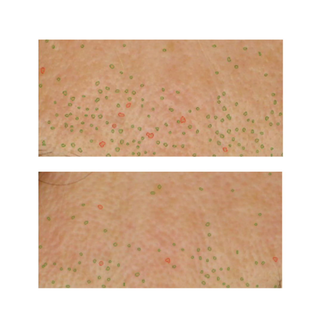 resultados visibles Suerum FARMA DORSCH sérum ultra hidratante con efecto lifting y mejora visible de la piel