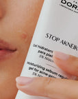 Primer plano de un rostro con imperfecciones aceneicas visibles sujetando el gel hidratante STOP AKNEIK de FARMA DORSCH. Tratamiento con 5% de niacinamida, formulado para pieles acneicas. Hidrata, regula el sebo y ayuda a reducir marcas y brotes de acné. taratmiento para la piel con tendencia acenéica