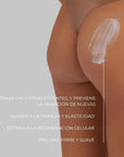 Aplicación de la crema antiestrías STRETCH MARKS de FARMA DORSCH sobre la piel de los glúteos, mostrando su textura cremosa. El tratamiento ayuda a atenuar estrías existentes, prevenir nuevas, mejorar la firmeza y elasticidad, y estimular la regeneración celular para una piel más suave. tratamientos